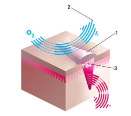 Illustration Wirkung Hydrogele